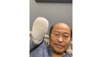 佐野慈紀さん　「ぬいぐるみみたい。。。」「至って元気」　右腕切断手術後、初めて写真を公開