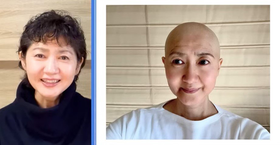 【がん闘病】古村比呂さん　抗がん剤治療による「脱毛」の記録　「参考にしてくれたら嬉しいなと思います」　　１年間の写真を公開