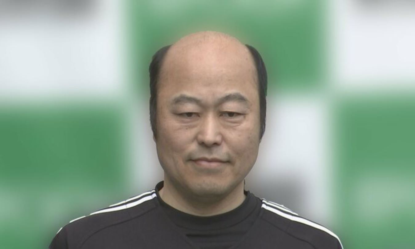 佐野慈紀さん「左投げでぴっかり投法」前向きに決意　1日に感染症で右腕切断