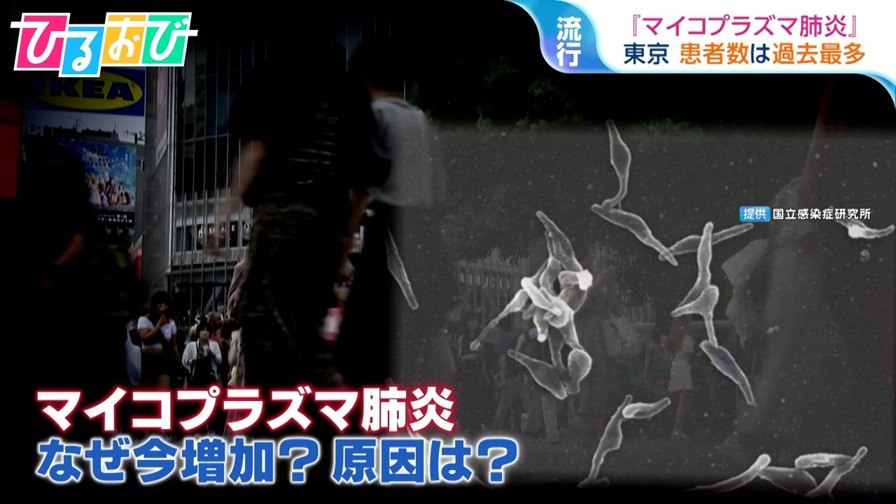 全国で感染拡大『マイコプラズマ肺炎』症状は風邪とどう違う？予防法は【ひるおび】