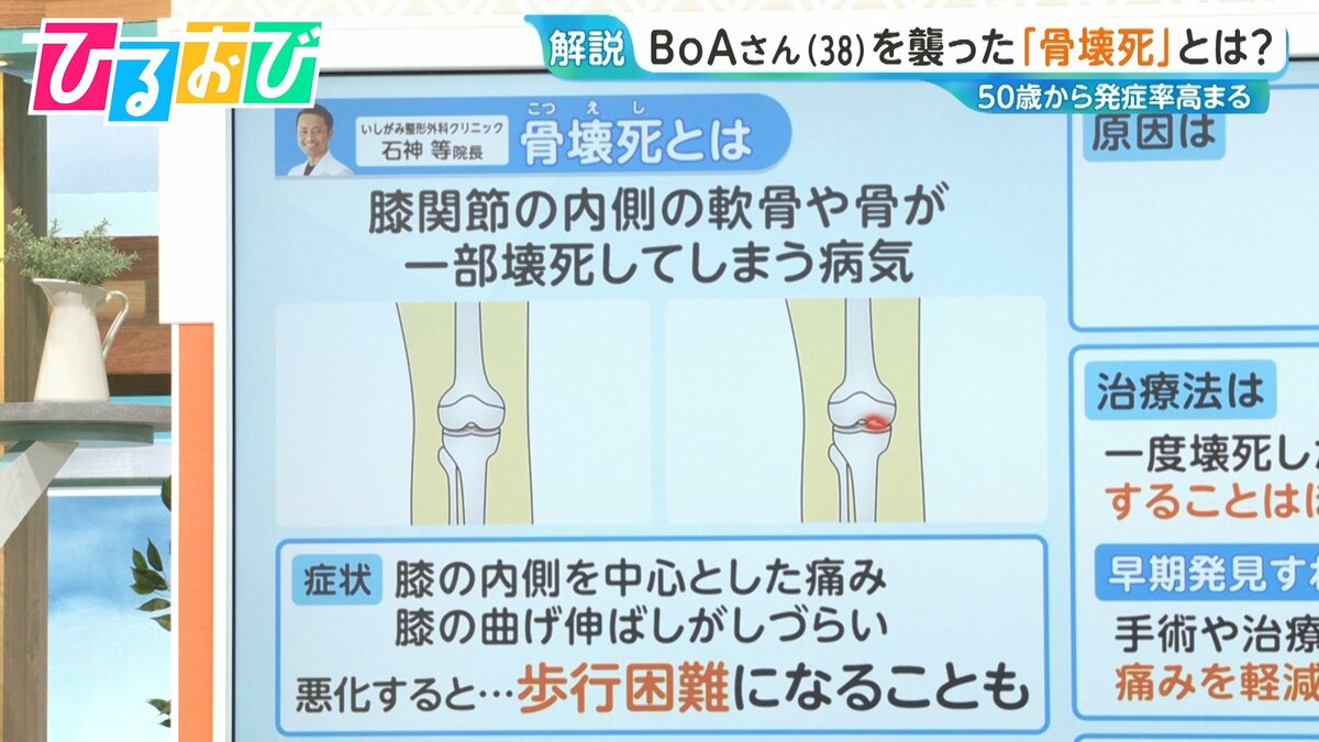 原因は不明『骨壊死』とはどんな病気?治療法や気を付けるべきことを専門医に聞く【ひるおび】