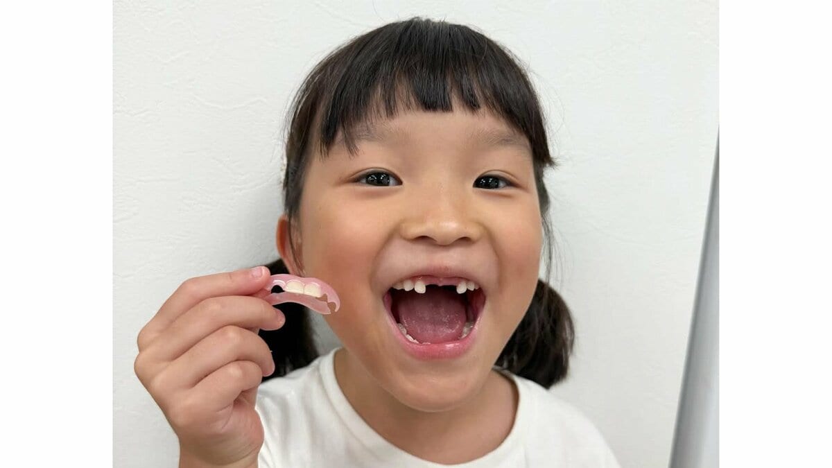 【ののちゃん】「かっこいい〜!」初めての仮歯に大喜び 歯医者での不安から笑顔へ変わる成長の瞬間