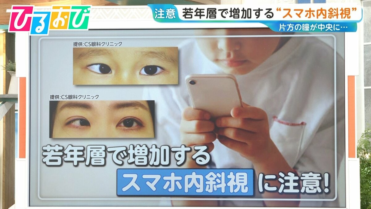 スマホやゲーム機を長時間近くで…子どもの“スマホ内斜視”が増加 対策は?【ひるおび】