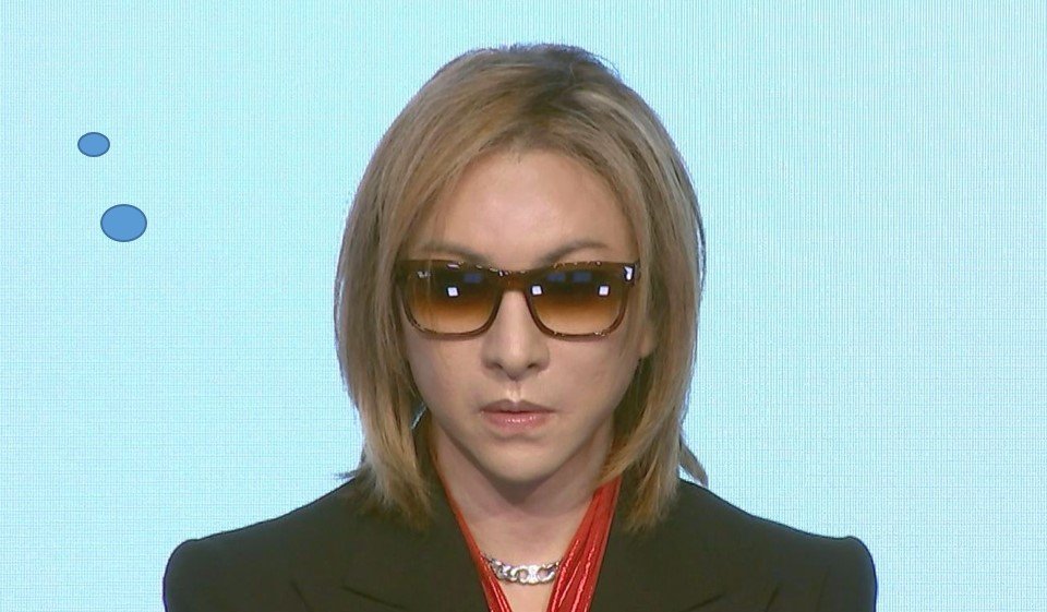 【 YOSHIKI 】 右手を負傷 「公演中、一部のお客様による右手への強い接触行為(つかむ・引っぱる)により」 現在「3度目の首の手術を経て行う復活の公演」の最中