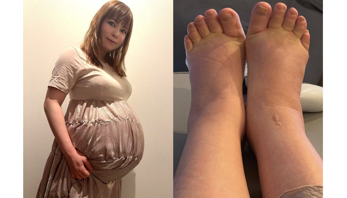 【 中川翔子 】 「むくみも人間の限界にきてる」　双子妊娠中　現況明かす　「塩分だけじゃなく双子の圧迫もある、、あと少しを楽しむ！ギリギリまでがんばろう」