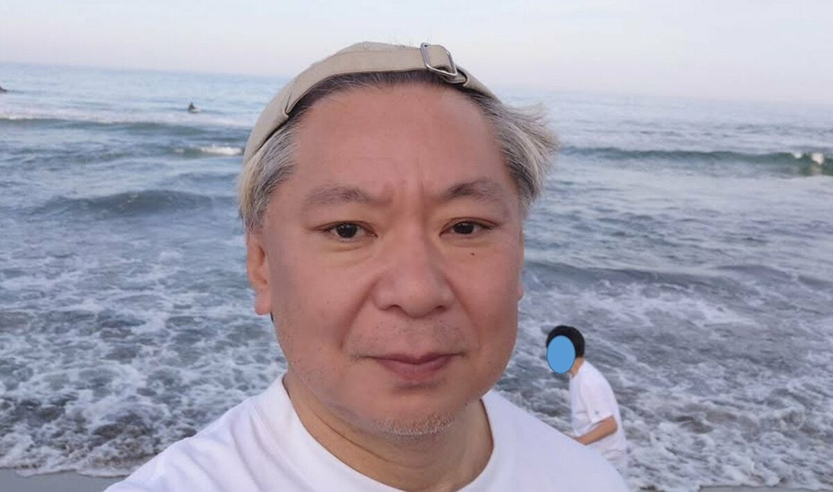 【 鈴木おさむ 】 「歯茎の状態わるく、前歯二本抜歯！」　更に手術も　「自分の血液で作った歯の素的なものを歯茎に入れる手術を行うことになる」