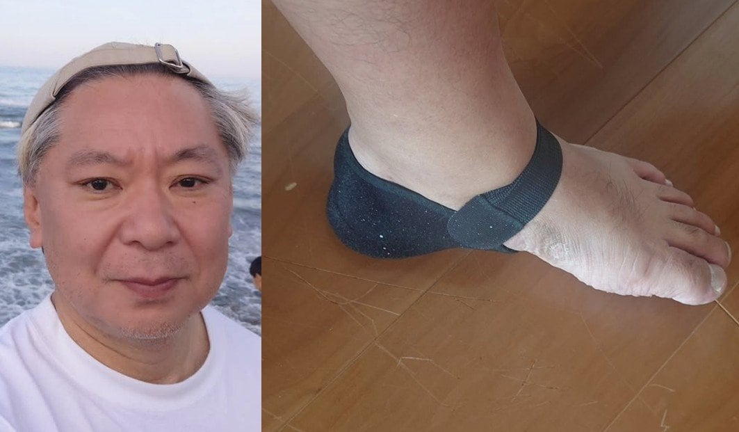 【 鈴木おさむ 】 「足底腱膜炎になりました。多分。めっちゃ痛いです」「日に日に痛みは増してる感じが」　現況明かす