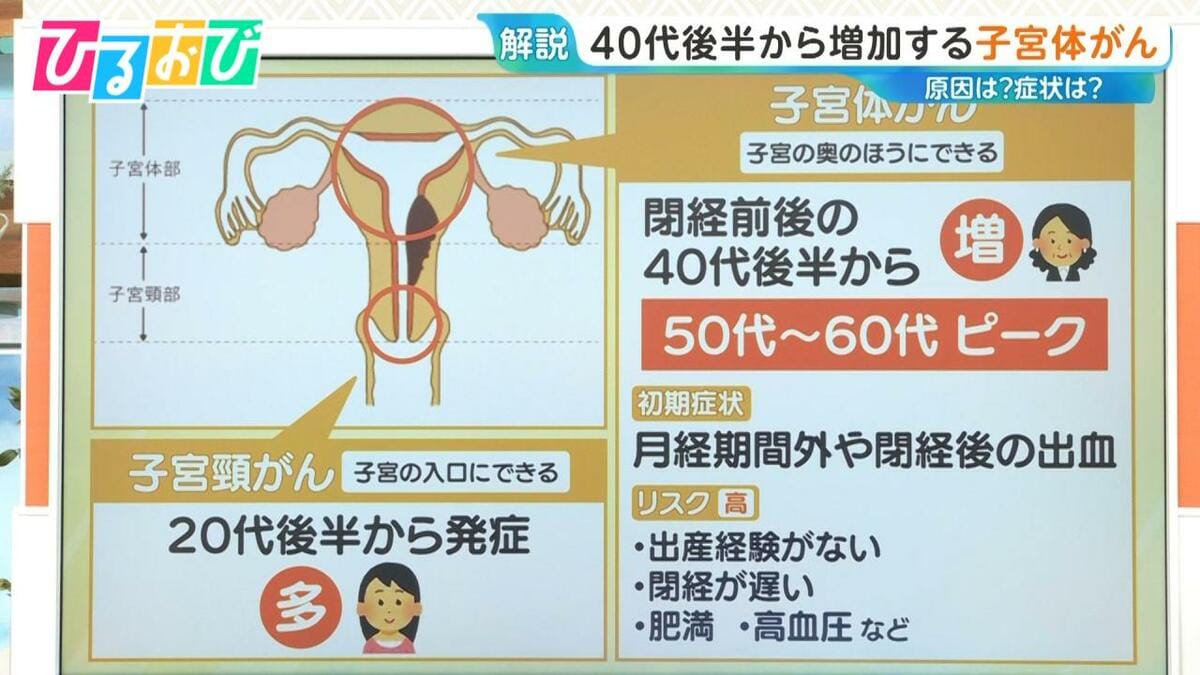 40代後半から増加「子宮体がん」初期症状は“不正出血” 検診の頻度やタイミングは【ひるおび】