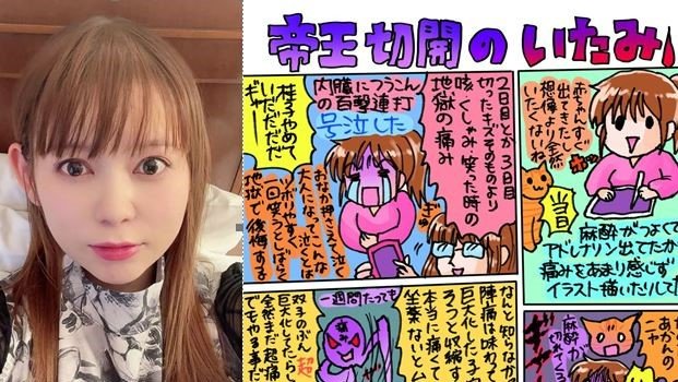 【中川翔子】「お腹痛すぎる まだ後陣痛?が全然やばい」帝王切開出産後の痛みを絵日記で報告