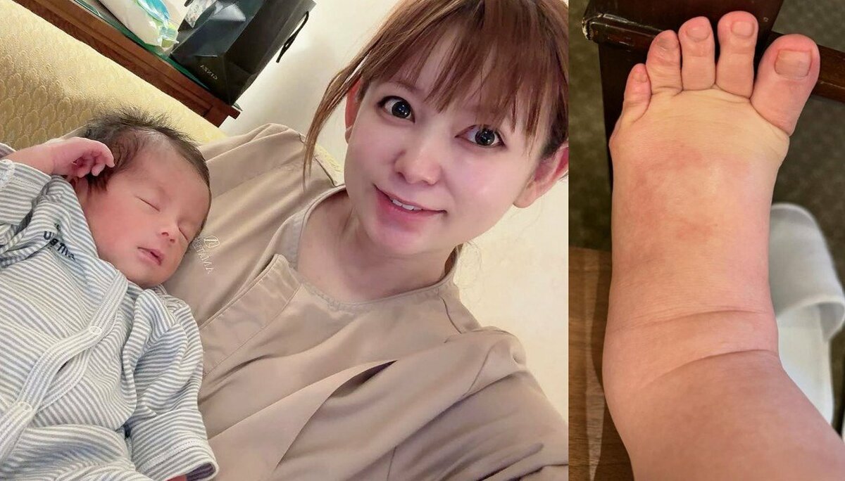 【 中川翔子 】 「双子ワンオペ無理」「大変さもあるけどそれ以上に愛おしい」 現況明かす 「むくみとのたたかい 着圧ソックス履く前と履いた後の違いがすごすぎる」