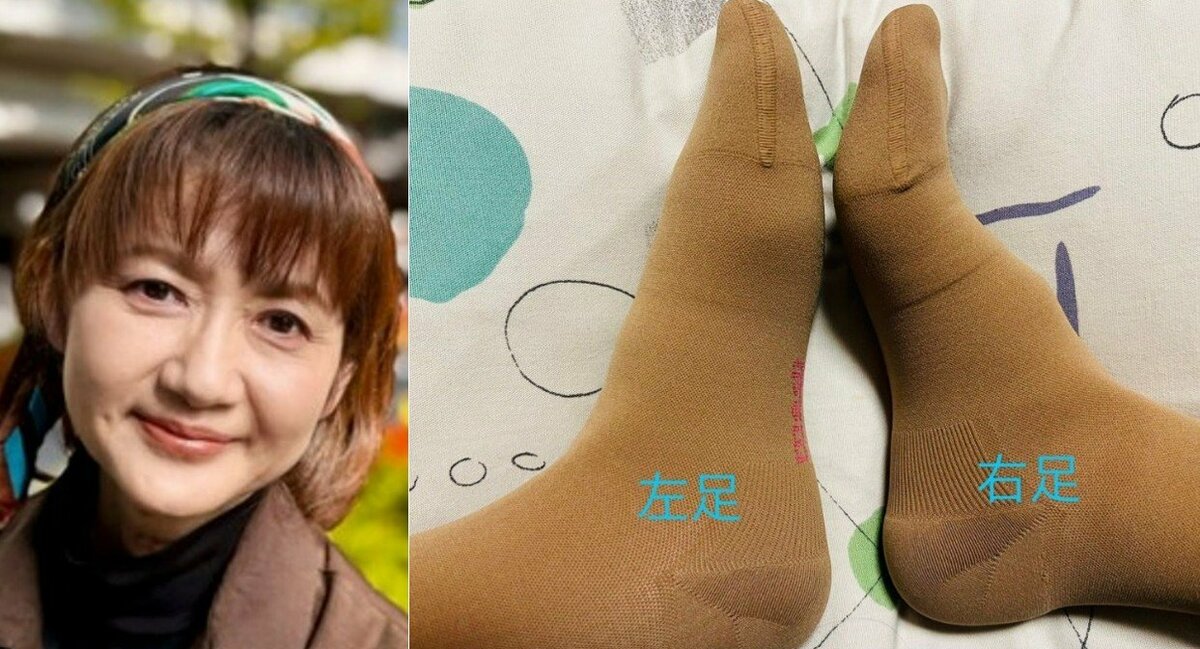 【 がん闘病 】古村比呂さん リンパ浮腫で「左脚の浮腫みは 足裏に溜まるように」「私の左足は 土踏まずがほぼ 無くなってます」