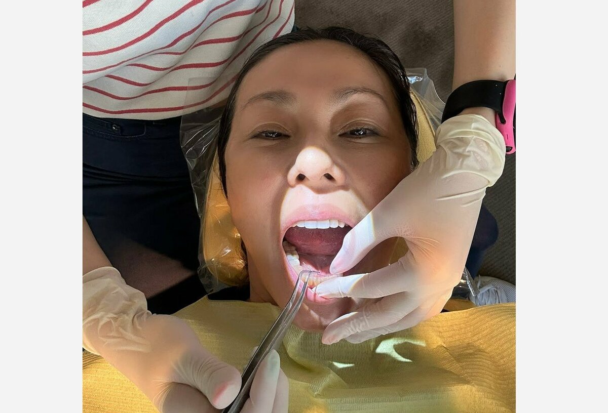 【 RIKACO 】　歯の矯正が完了　「こんな顔でごめんなさい　でもね　嬉しくてー」「長年下の歯並びが悪くて悩みだったの」