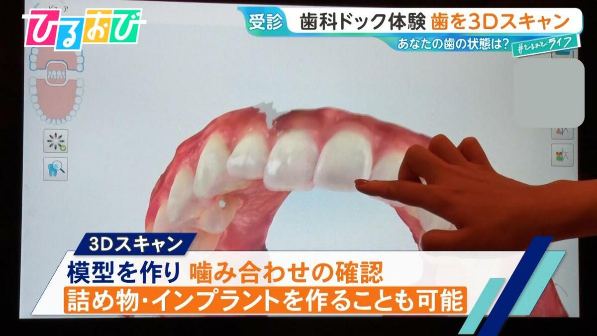 2人に1人が『歯周病』…予防に有効な「歯科ドック」って何をする?歯科医が教える簡単ケア術【ひるおび】