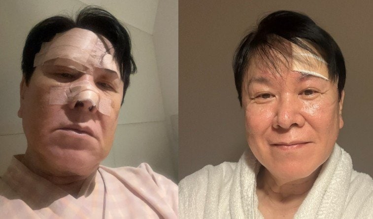 【 三ツ矢雄二 】転倒・鼻を骨折から1か月半ぶりに仕事復帰「大分、症状もやわらいできましたが、頭はまだジンジンしています」