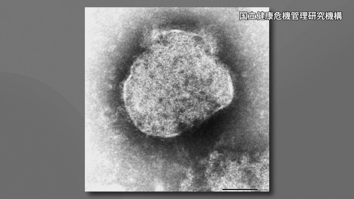 「はしか」の感染者数　今年に入り累計100人に　前年同時期の4倍以上
