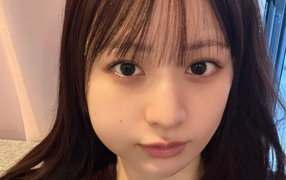 【CANDY TUNE・立花琴未】親知らず抜歯後の画像を公開「痛くてメイクする余裕がなく、初めてすっぴん」