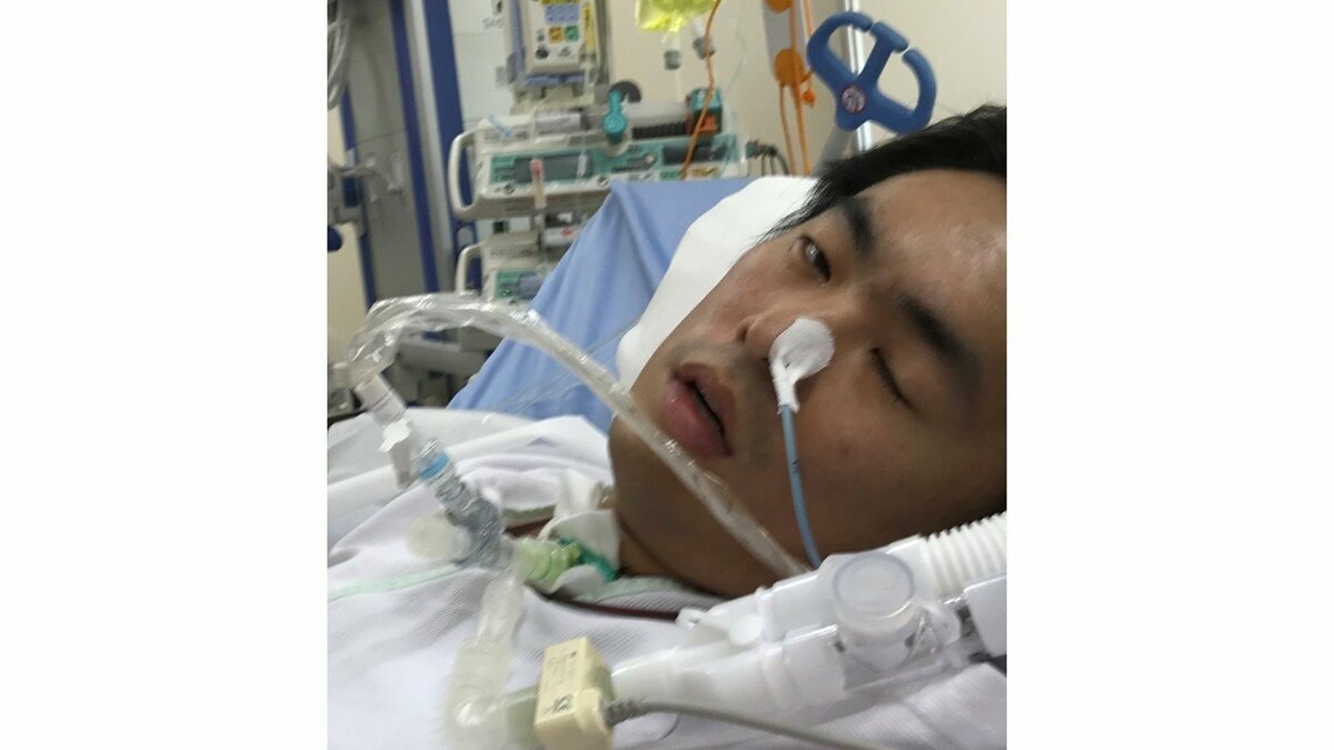 【 両肺移植 】音楽ユニット『モトブル』松本さん「移植の前と後の想いは繋がっていて感謝の日々続く」　4月中にダウン症ダンサー・Yutoさんを歌った楽曲リリースも