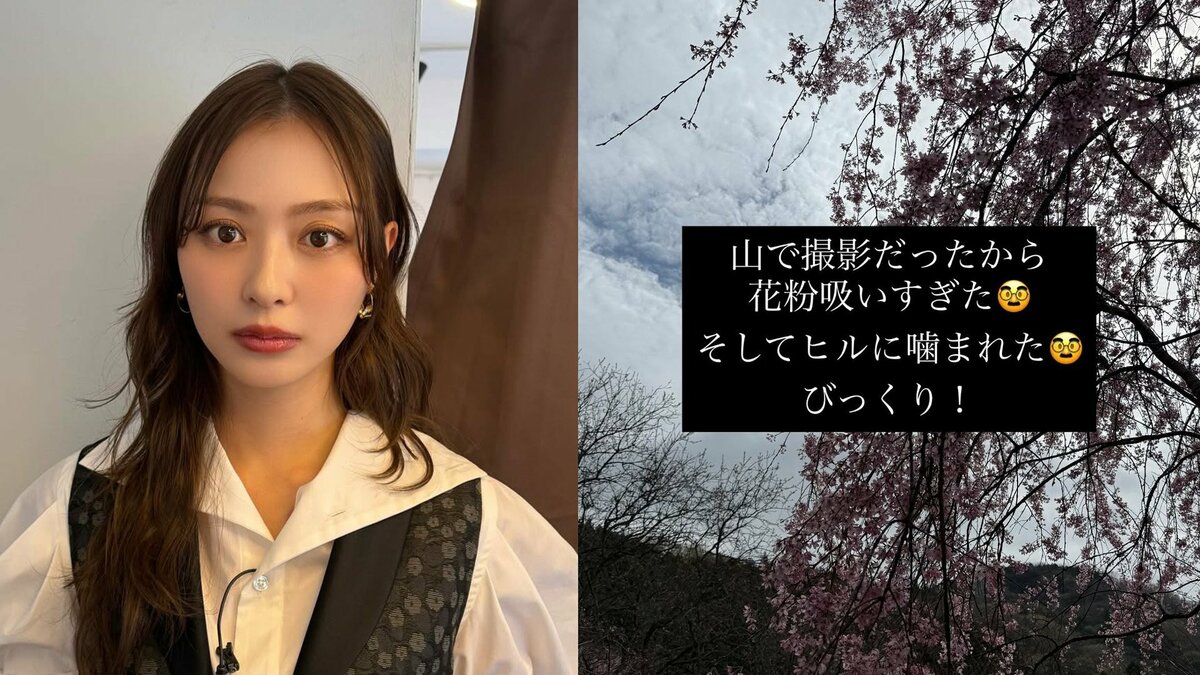 【 内田理央 】 「花粉症でスギとヒノキにやられて」「毎朝目がくっついちゃって開かないよう」 重度花粉症の現況を告白 撮影現場ではヒルに噛まれる