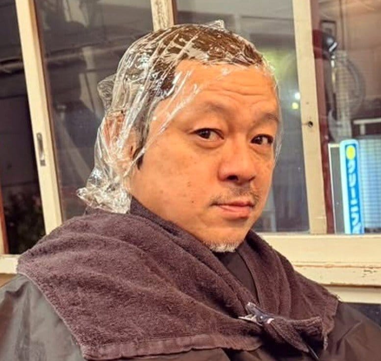 【 水玉れっぷう隊・ケン 】　白髪染めで「アレルギー反応」 「頭皮が無性に痒くなり」「ボリボリしたら、頭皮から透明の汁が」「頭と顔と首が腫れ出して、熱も出だし」