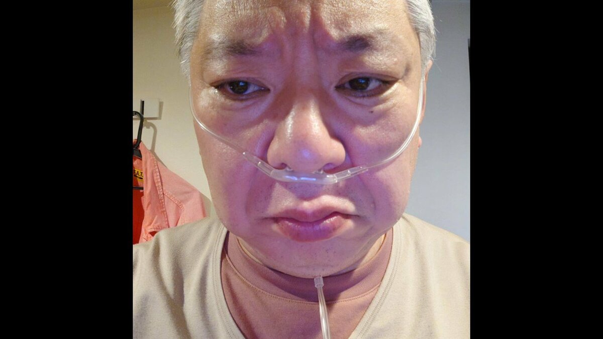 【 鈴木おさむ 】体調不良で救急外来へ「身体しんどくて、１日が長い！！」　27日には『無呼吸睡眠検査』で“チューブ姿”投稿も