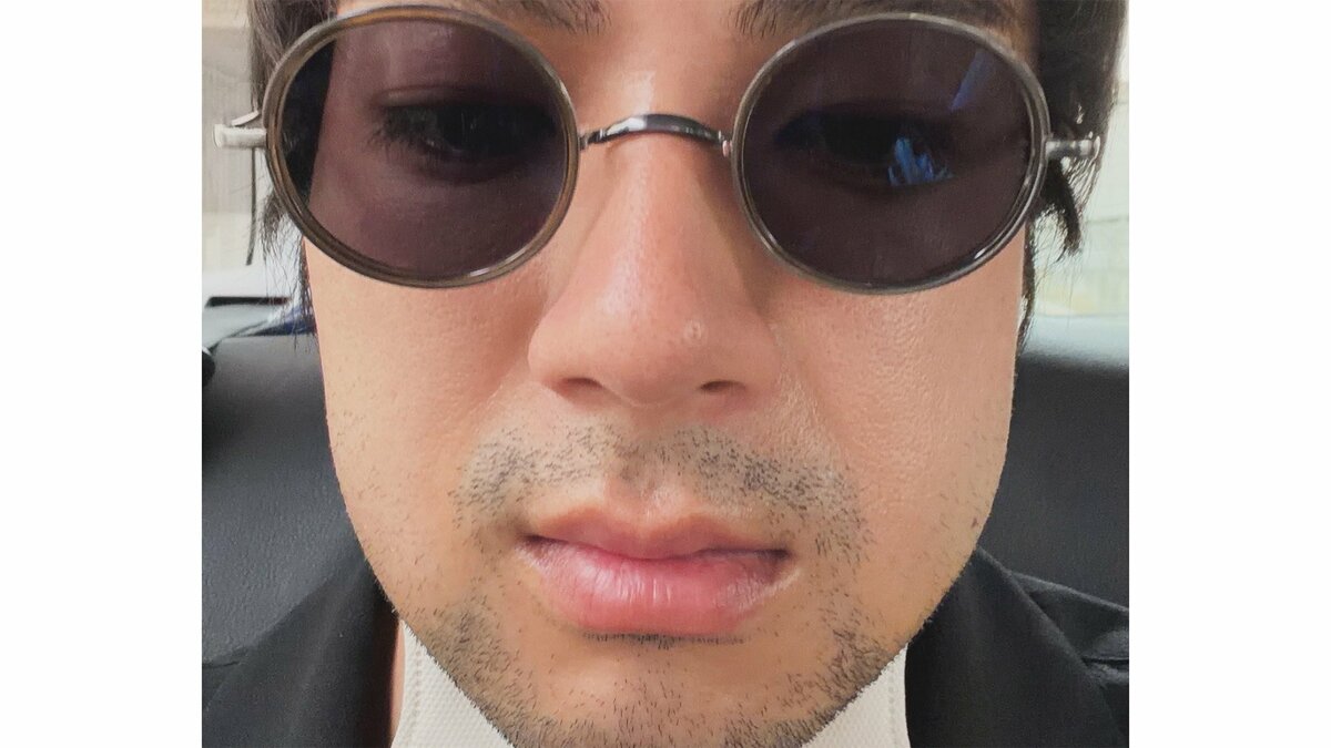 【 山田裕貴 】　親知らず抜歯で“ふにゃふにゃ声”の緊急事態　頬が腫れた自撮り公開にファン「お大事に」「無事に舞台挨拶できますように」