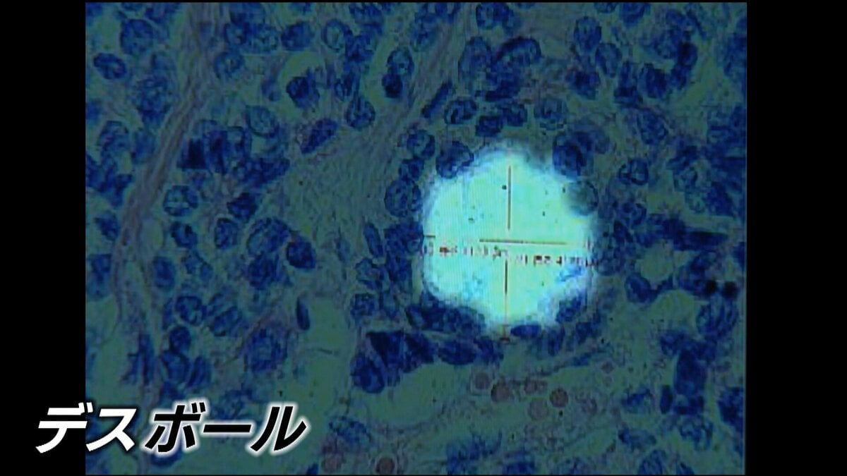 「デスボール」原爆の放射線が体内に留まり細胞に“穴”を 最新の研究発表が波紋…長崎原爆から81年 置き去りの被爆体験者【NO WARプロジェクト つなぐ、つながる】