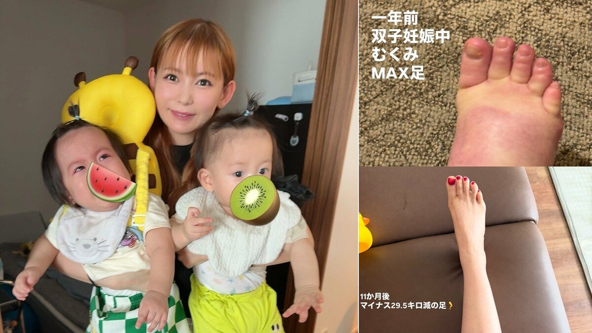 【 中川翔子 】双子が生後11か月「もう0歳でいられるのがあとわずか！尊い！」　絵日記で成長を報告　「むくみMAX足」と「マイナス29.5キロ減の足」も公開