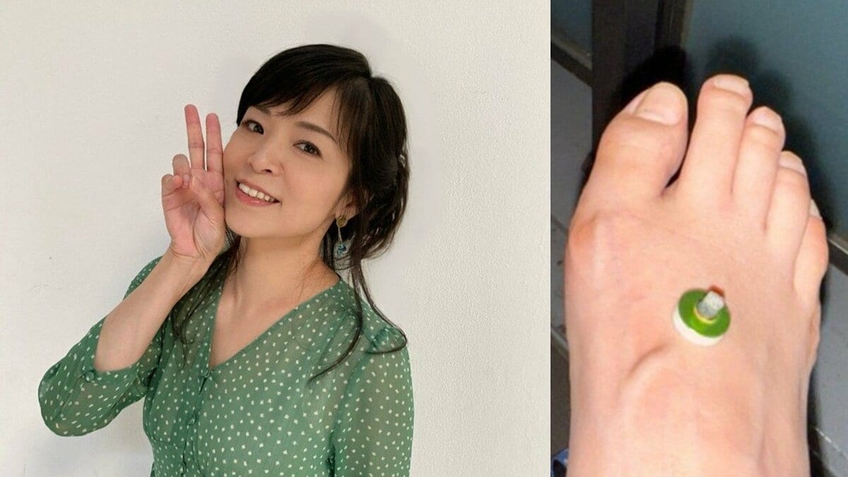 【 石原詢子 】放射線治療が折り返しに 「今は上手に付き合うしかないですね・・」足の浮腫対策を明かす