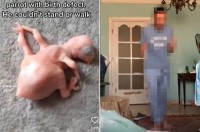 【世界で話題となった動画】先天性欠損症で産まれたインコのヒナ。献身的に治療した男性が、ヒナが歩いた喜びを爆発させる動画に感動！
