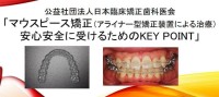 日本臨床矯正歯科医会がマウスピース矯正（アライナー矯正）治療で知っておくべき5つのポイントを伝授　トラブルを未然に防ぐべく、まずは認定医に相談を