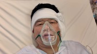 ダイアン・津田さん　手術を報告　真珠腫性中耳炎のため　「高熱が出るんですよね。それがねなかなかしんどくて」　全身麻酔で