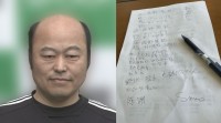 佐野慈紀さん　「字の練習　なかなか難しい」　右腕切断手術後の状況明かす