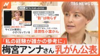 【Nスタ生出演】乳がん公表 梅宮アンナさん（51）「初めてのことなので不安と恐怖」「正しい情報の見極めが必要」