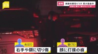 【速報】「知らない人が刃物で」男が住宅に侵入　高齢夫婦が切りつけられる　警察が行方追う