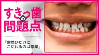 子どもと大人で異なる「すきっ歯」のとらえ方　「歯並びだけにこだわるのは卒業を」と矯正歯科医が指摘する理由