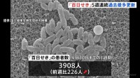 「百日せき」の患者数が5週連続で過去最多更新　全国で1週間の患者数が3908人にのぼる