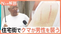 「後ろに押し倒され…」住宅街でクマに襲われた男性が語る恐怖の瞬間【Nスタ解説】