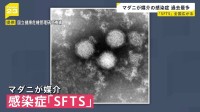 マダニ媒介の感染症「SFTS」感染者数が過去最多 今月10日までに135人　国内患者の致死率は27%　草の茂った場所では長そで・長ズボンの着用呼びかけ 厚労省