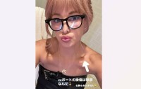 【 梅宮アンナ 】 「cvポートの後傷は勲章なんだ」　鎖骨あたりに残る傷跡を公開　「右胸もありません」　明るく報告