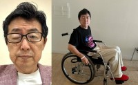 【 笠井信輔 】　帯状疱疹で「入院後は車椅子生活に」「脳がかなり疲れていた」　右目が開かず
