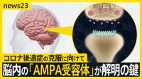 コロナ後遺症「ブレインフォグ」克服の糸口につながる研究結果 患者の脳を分析「アンパ受容体」の密度が健常者より高いと判明 横浜市立大学病院 新たな臨床試験も【news23】