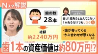歯1本の資産価値は約80万円!? 歯周病になりやすい人の特徴、予防法は？ フロスと歯間ブラシどっちがいいの？【Nスタ解説】