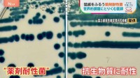 薬が効かなくなる“薬剤耐性菌”2050年には世界で年間1000万人超死亡のおそれが… 世界的課題に取り組む医師　“抗菌薬の適正使用と感染対策”