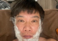 【 TKO・木本武宏 】　人生初「顔のイボ取り」を報告　「細かく100個くらいあるんやって　まず今日はまず30個ほど取る」