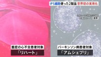 iPS細胞の2製品が世界初の実用化　重症の心不全の患者対象「リハート」・パーキンソン病患者を対象「アムシェプリ」 早ければ夏ごろに実用化