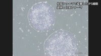 【速報】iPS細胞使ったパーキンソン病患者の再生医療製品「アムシェプリ」 公的医療保険の適用を了承 価格は約5530万円 中医協