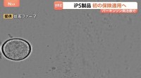 iPS細胞使った再生医療製品 公的医療保険の適用を了承　パーキンソン病治療“年内に1人目の移植を目指す”