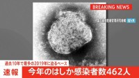 【速報】今年のはしか感染者数462人　過去10年で最多だった2019年に迫るペース　厚生労働省