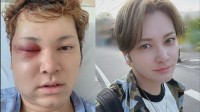 【 10万人に1人の難病・間瀬翔太 】　40歳迎えた想い綴る　「生きるってめちゃくちゃ難しいけど、本当に幸せ」「無事に41歳になれます様に」 【 脳動静脈奇形 】