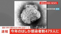 【速報】今年のはしか感染者数479人　過去10年で最多だった2019年に迫るペース